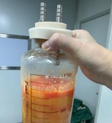 南宁水动力吸脂手术要做多久？